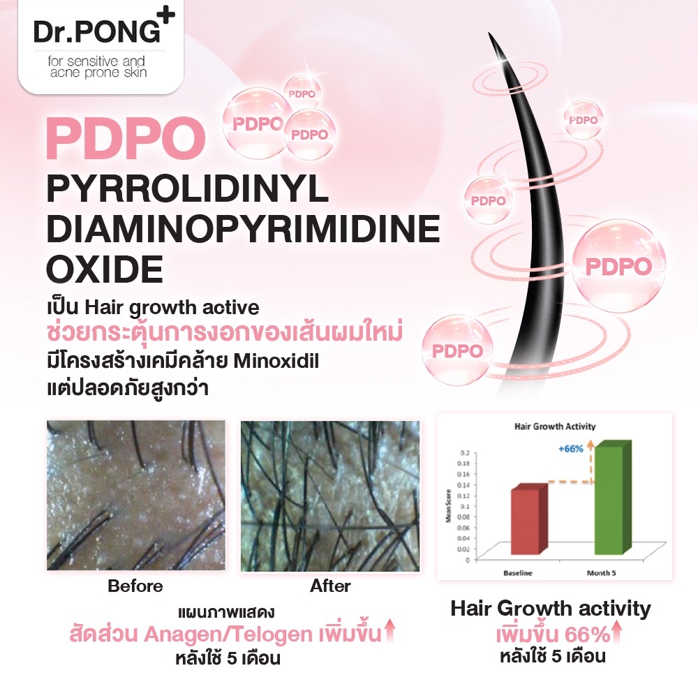 ภาพเพิ่มเติมของ Dr.PONG TSUTSUJI GENTLE SHAMPOO แชมพูลดผมร่วง anti-hairloss shampoo ขนาด 200ml
