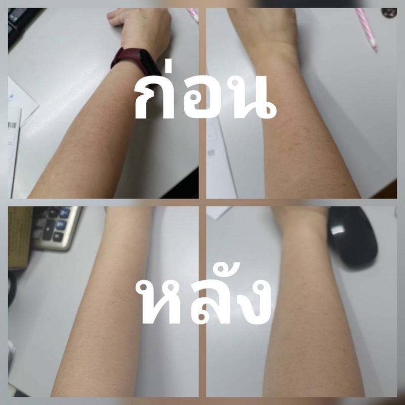ภาพเพิ่มเติมของ หัวไชเท้าออร์แกนิคสกัดเย็น100% เช็ดฝ้าก่อนทาครีม ผสมครีม สลายฝ้ากระ