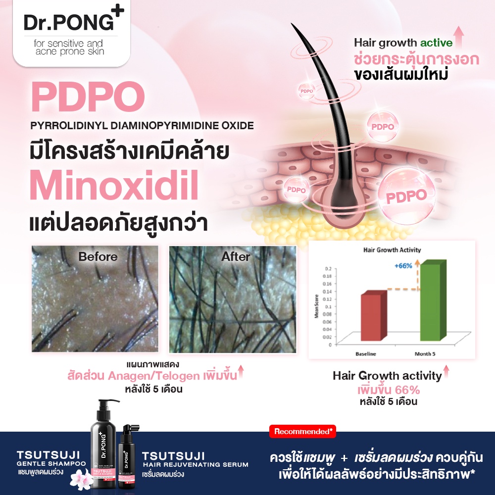 ภาพเพิ่มเติมของ [2 ฟรี แชมพู] เซรั่มลดผมร่วง Dr.PONG TSUTSUJI HAIR REJUVENATING SERUM - anti-hairloss serum เซรั่มบำรุงผม ลดผมร่วง