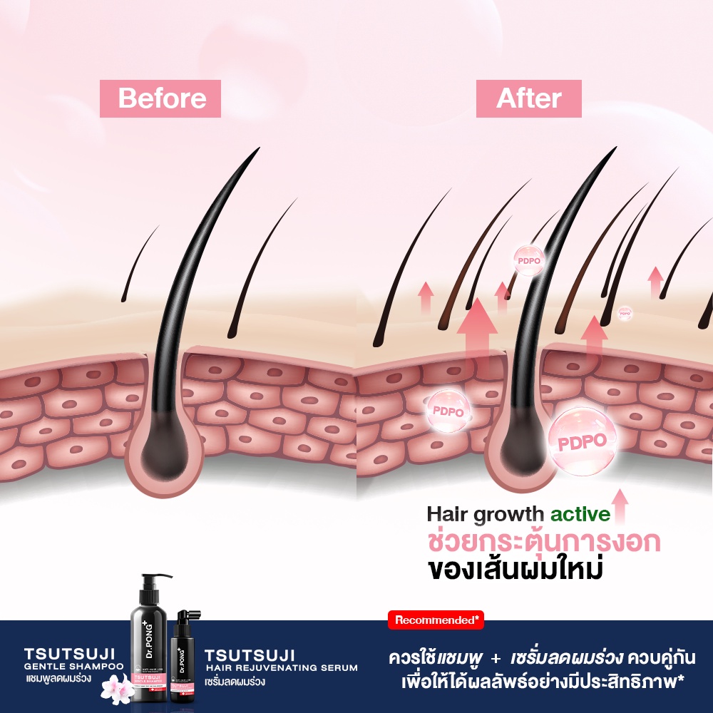 ภาพเพิ่มเติมของ [2 ฟรี แชมพู] เซรั่มลดผมร่วง Dr.PONG TSUTSUJI HAIR REJUVENATING SERUM - anti-hairloss serum เซรั่มบำรุงผม ลดผมร่วง