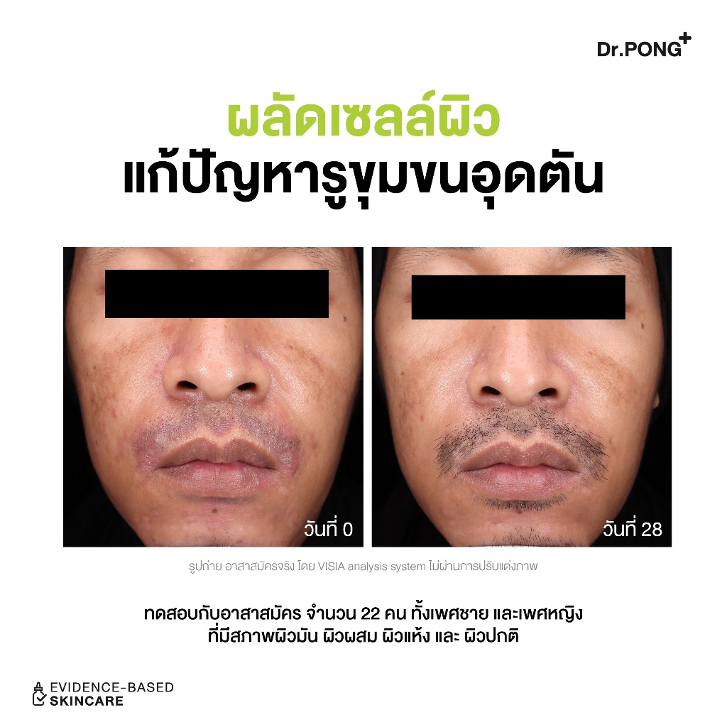 ภาพเพิ่มเติมของ Refill pack 300 ml Dr.PONG p55 BHA Acne Clear face wash เจลล้างหน้าสูตรอ่อนโยน