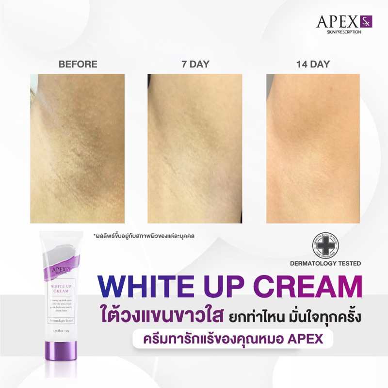 ภาพเพิ่มเติมของ APEX-SX WHITE UP CREAM ครีมทารักแร้ขาว โดยแพทย์ผิวหนังเอเพ็กซ์ ทาขาหนีบดำ แก้มก้นดำ 50 ml.