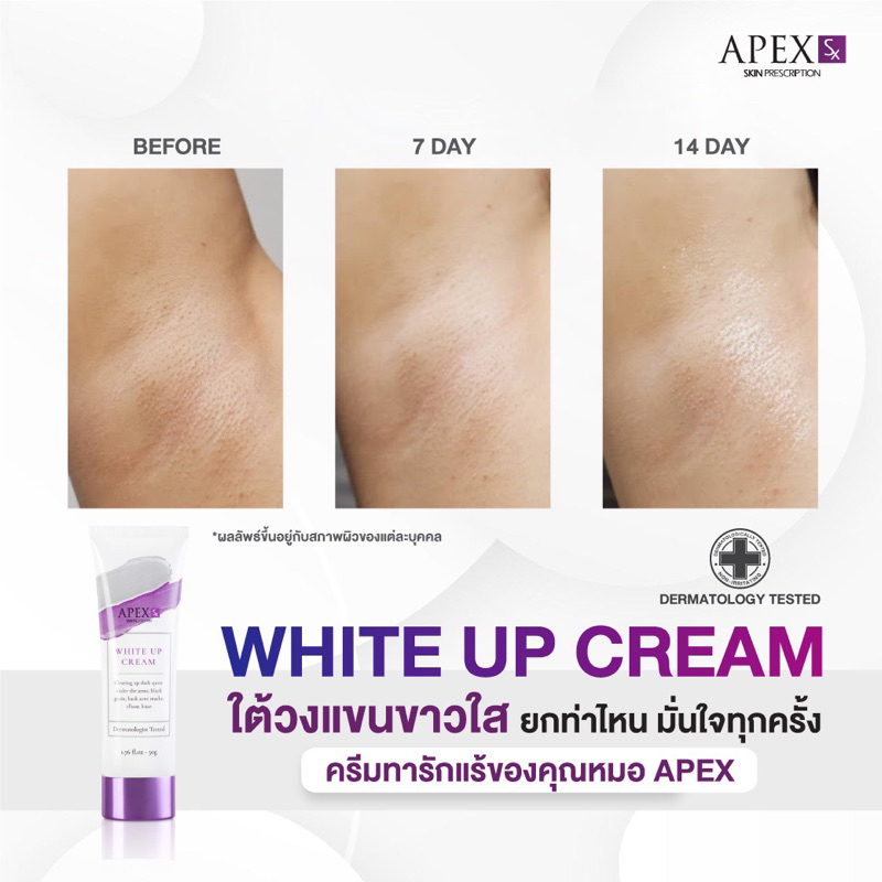 ภาพเพิ่มเติมของ APEX-SX WHITE UP CREAM ครีมทารักแร้ขาว โดยแพทย์ผิวหนังเอเพ็กซ์ ทาขาหนีบดำ แก้มก้นดำ 50 ml.