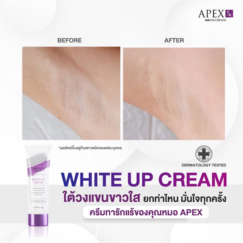 ภาพเพิ่มเติมของ APEX-SX WHITE UP CREAM ครีมทารักแร้ขาว โดยแพทย์ผิวหนังเอเพ็กซ์ ทาขาหนีบดำ แก้มก้นดำ 50 ml.