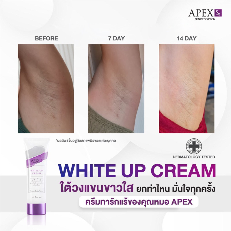 ภาพเพิ่มเติมของ APEX-SX WHITE UP CREAM ครีมทารักแร้ขาว โดยแพทย์ผิวหนังเอเพ็กซ์ ทาขาหนีบดำ แก้มก้นดำ 50 ml.