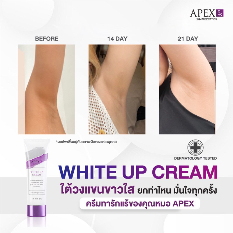 ภาพเพิ่มเติมของ APEX-SX WHITE UP CREAM ครีมทารักแร้ขาว โดยแพทย์ผิวหนังเอเพ็กซ์ ทาขาหนีบดำ แก้มก้นดำ 50 ml.