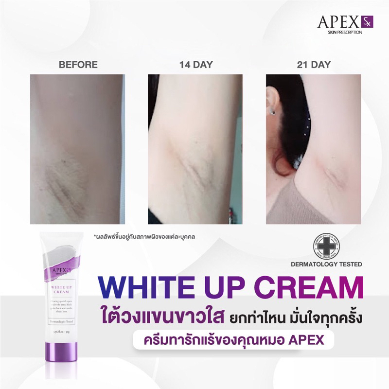 ภาพเพิ่มเติมของ APEX-SX WHITE UP CREAM ครีมทารักแร้ขาว โดยแพทย์ผิวหนังเอเพ็กซ์ ทาขาหนีบดำ แก้มก้นดำ 50 ml.
