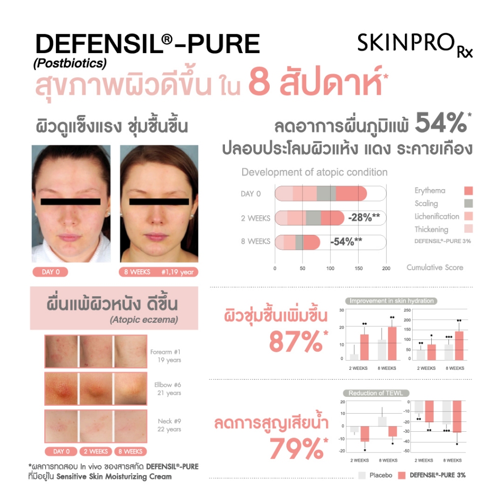 ภาพเพิ่มเติมของ SKINPRO Rx Sensitive Skin Moisturizing Cream มอยซ์เจอร์ไรเซอร์บำรุงผิว สำหรับผิวบอบบางแพ้ง่าย ชุ่มชื้น ผิวแข็งแรง 50ml.