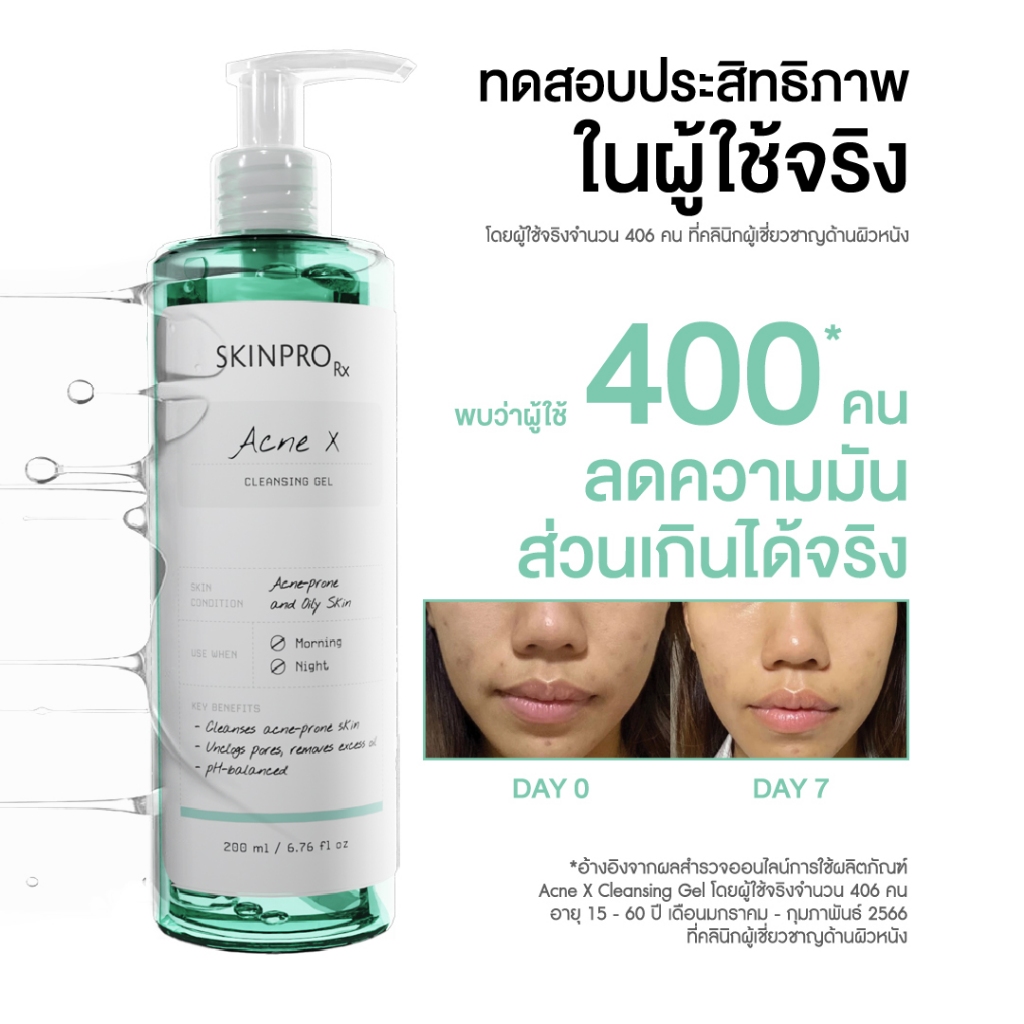 ภาพเพิ่มเติมของ SKINPRO Rx Acne X Cleansing Gel คลีนซิ่งเจลสูตรสำหรับผิวมัน/เป็นสิว ลดการเกิดสิว ไซส์ใหญ่ 200ml.