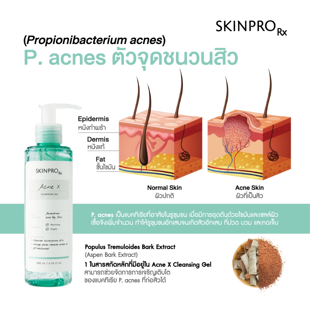 ภาพเพิ่มเติมของ SKINPRO Rx Acne X Cleansing Gel คลีนซิ่งเจลสูตรสำหรับผิวมัน/เป็นสิว ลดการเกิดสิว ไซส์ใหญ่ 200ml.