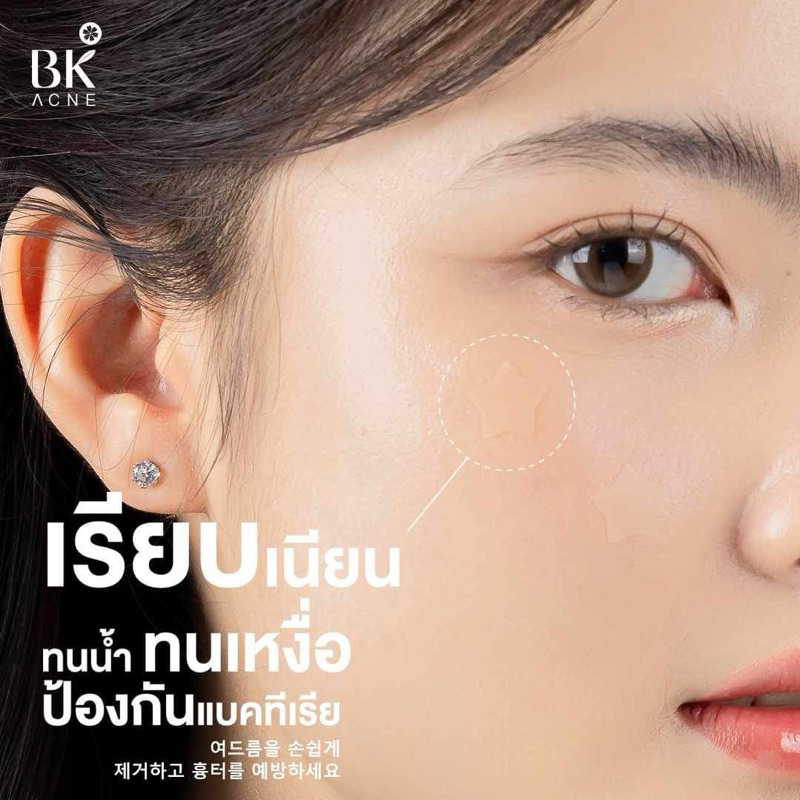 ภาพเพิ่มเติมของ BK ACNE STAR PATCH แผ่นแปะสิว bk Hydrocolloid รูปดาว ขอบบาง กันน้ำ แต่งหน้าเนียน สำหรับคนเป็นสิว ผิวเเพ้ง่าย1ซอง