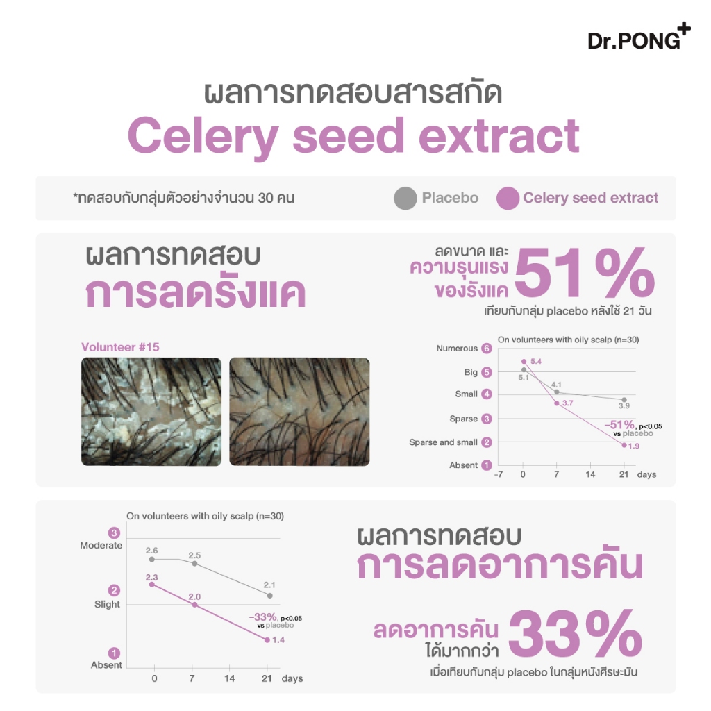 ภาพเพิ่มเติมของ Dr.PONG Dry X Shampoo Hair Spray ดรายแชมพูลดผมมันทันที ผมหอมสะอาด สดชื่น