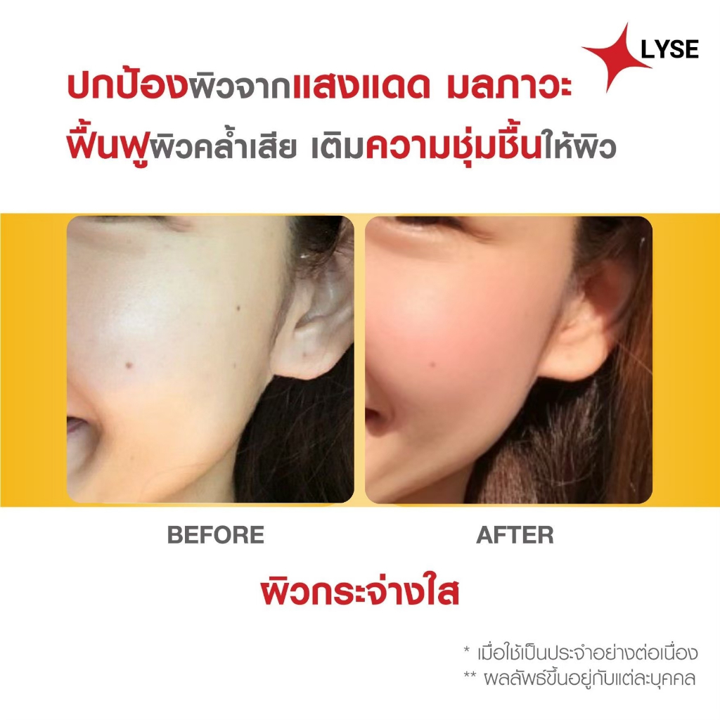 ภาพเพิ่มเติมของ โปร 2 แถม 1 กันแดดไม่ง้อรองพื้น SPF 50 PA+++ 2 หลอด แถม เซรั่มขนาดพกพา 10 กรัม ลิเซ่ LYSE