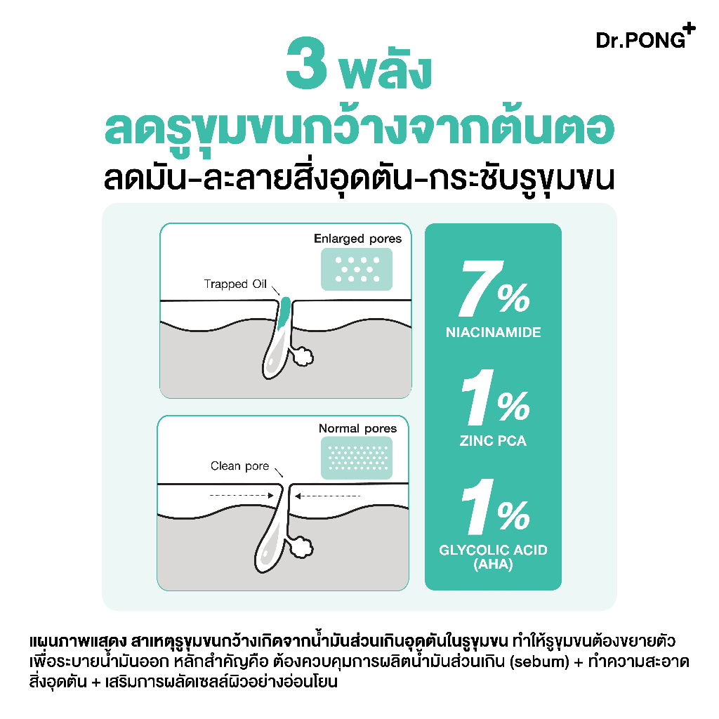 ภาพเพิ่มเติมของ [2 ขวด ฟรี 15ml] เซรั่มสูตรใหม่! Gen2 Dr.PONG 711 Poreless activein serum เซรั่มลดผิวมัน รูขุมขนแลดูกระชับ