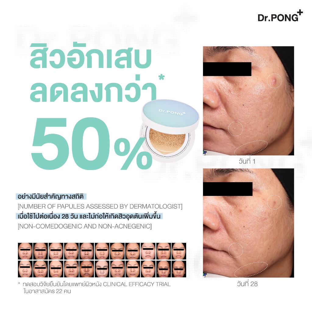 ภาพเพิ่มเติมของ [1 ฟรี 1] คุชชั่นลดสิว Dr.PONG ACNE ACE LONGWEAR CUSHION คุมมัน ติดทนกันน้ำ ไม่หลุดง่าย ยืนยันด้วยงานวิจัย