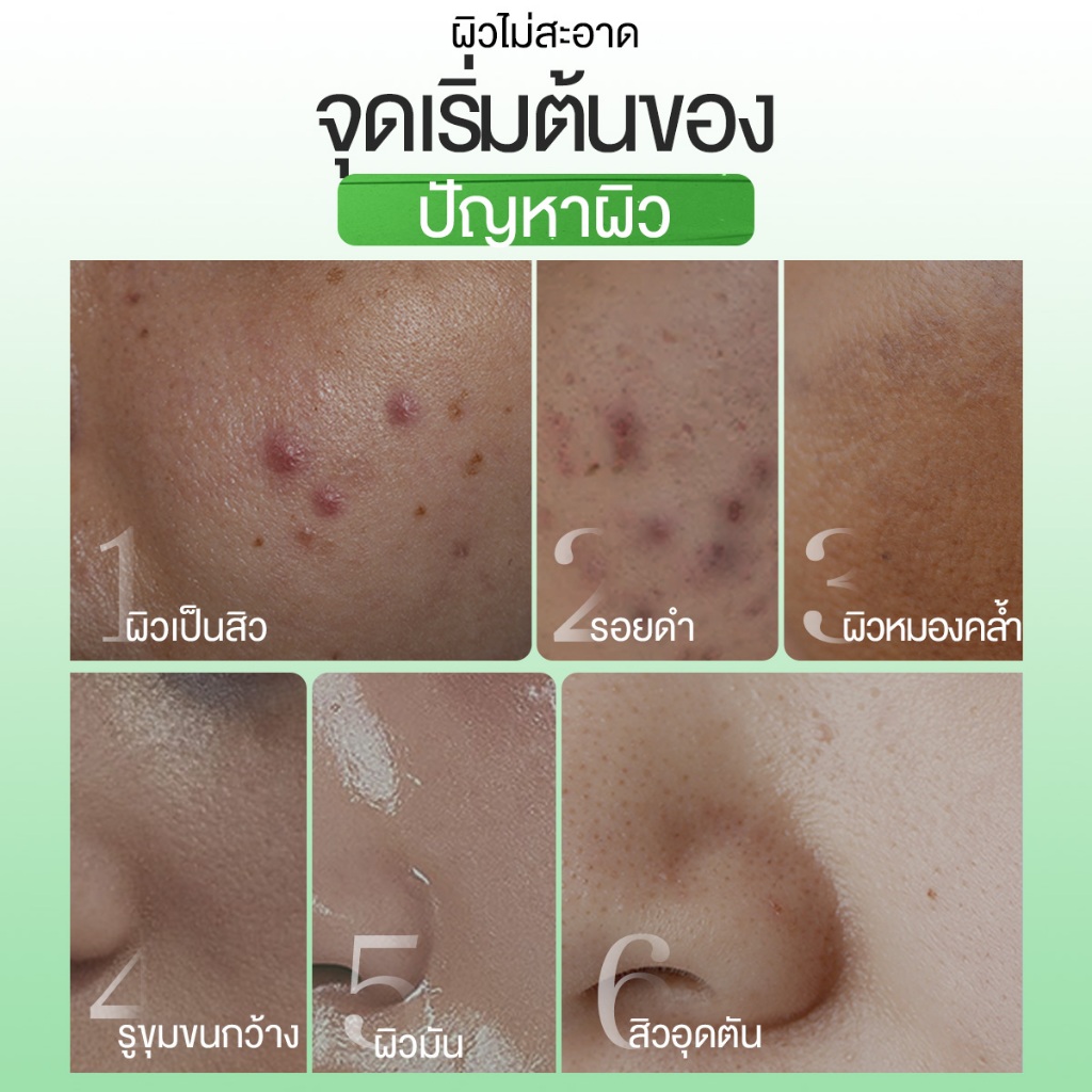 ภาพเพิ่มเติมของ SKINTIFIC Clay Mask Stick Mugwort สคินทิฟฟิค มัควอร์ธ แอคเน่ เคลย์ สติ้กซ์  มาร์คหน้า มาร์คโคลน ลดสิวหน้าใส ลด สิวเสี้ยน