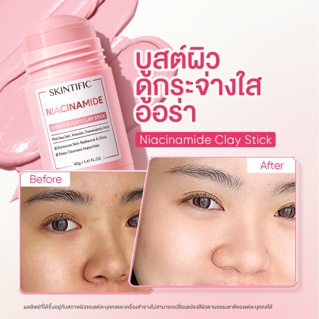 ภาพเพิ่มเติมของ SKINTIFIC Clay Mask Stick Mugwort สคินทิฟฟิค มัควอร์ธ แอคเน่ เคลย์ สติ้กซ์  มาร์คหน้า มาร์คโคลน ลดสิวหน้าใส ลด สิวเสี้ยน