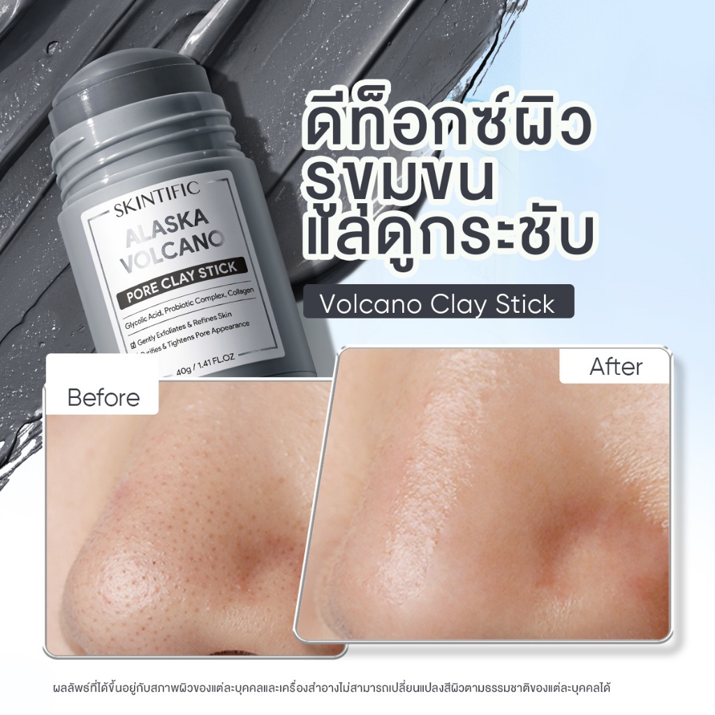 ภาพเพิ่มเติมของ SKINTIFIC Clay Mask Stick Mugwort สคินทิฟฟิค มัควอร์ธ แอคเน่ เคลย์ สติ้กซ์  มาร์คหน้า มาร์คโคลน ลดสิวหน้าใส ลด สิวเสี้ยน