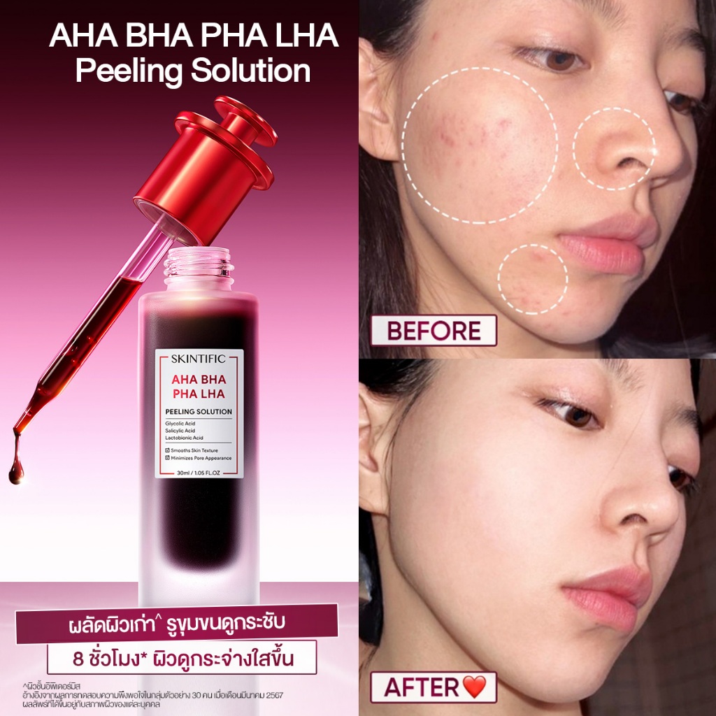 ภาพเพิ่มเติมของ [new]SKINTIFIC AHA BHA PHA LHA PEELING SOLUTION ผลัดผิวเสีย เผยผิวดูเนียนนุ่ม รูขุมขนดูกระชับ อัพผิวดูกระจ่างใส