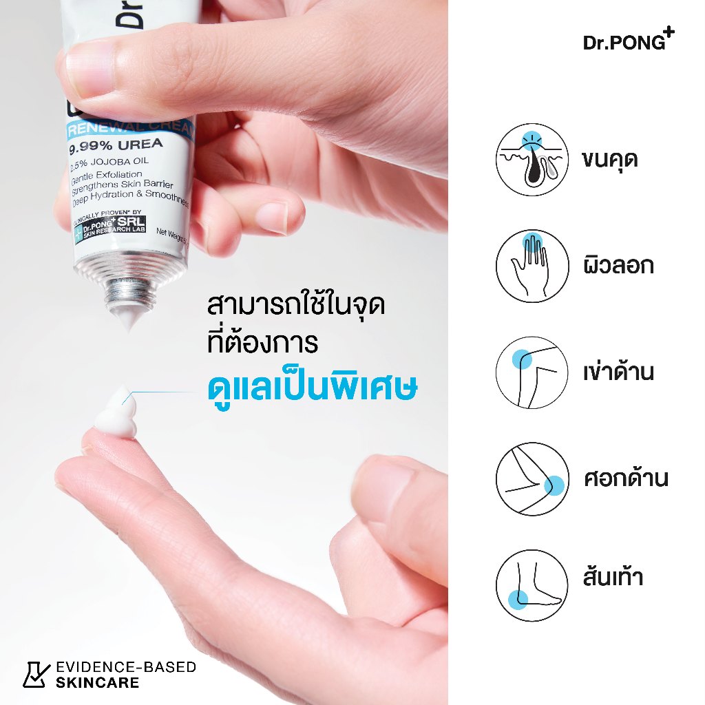 ภาพเพิ่มเติมของ [ลดแรง 9.9] [ขายดี] Dr.PONG U9.9 RENEWAL CREAM 50g  ครีมแก้ผิวแห้งลอก ขนคุด ศอกด้าน เข่าด้าน ผิวนุ่มชุ่มชื้น