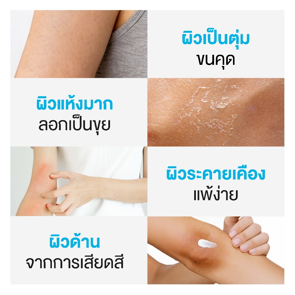 ภาพเพิ่มเติมของ [ลดแรง 9.9] [ขายดี] Dr.PONG U9.9 RENEWAL CREAM 50g  ครีมแก้ผิวแห้งลอก ขนคุด ศอกด้าน เข่าด้าน ผิวนุ่มชุ่มชื้น