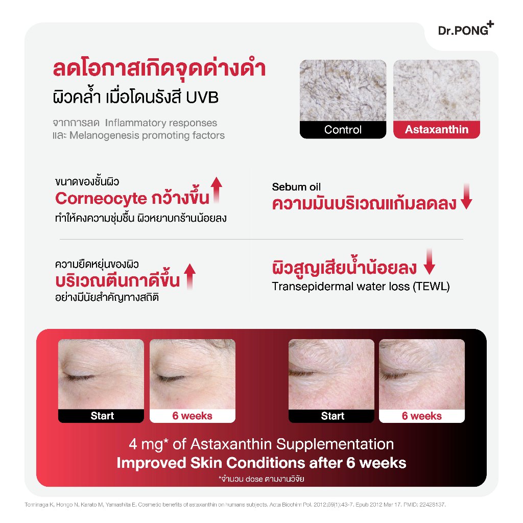ภาพเพิ่มเติมของ ใหม่! Dr.PONG ASTAXANTHIN MINI 6 MG PLUS VITAMIN E  สูตรใหม่ แอสตาแซนธิน มินิ 6 มก. พลัส วิตามิน อี ลดริ้วรอย ผิวเด้ง